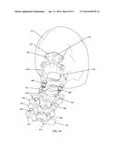 ARTICULATING SPINAL ROD SYSTEM diagram and image