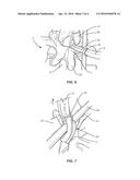 SURGICAL SYSTEM AND METHOD diagram and image