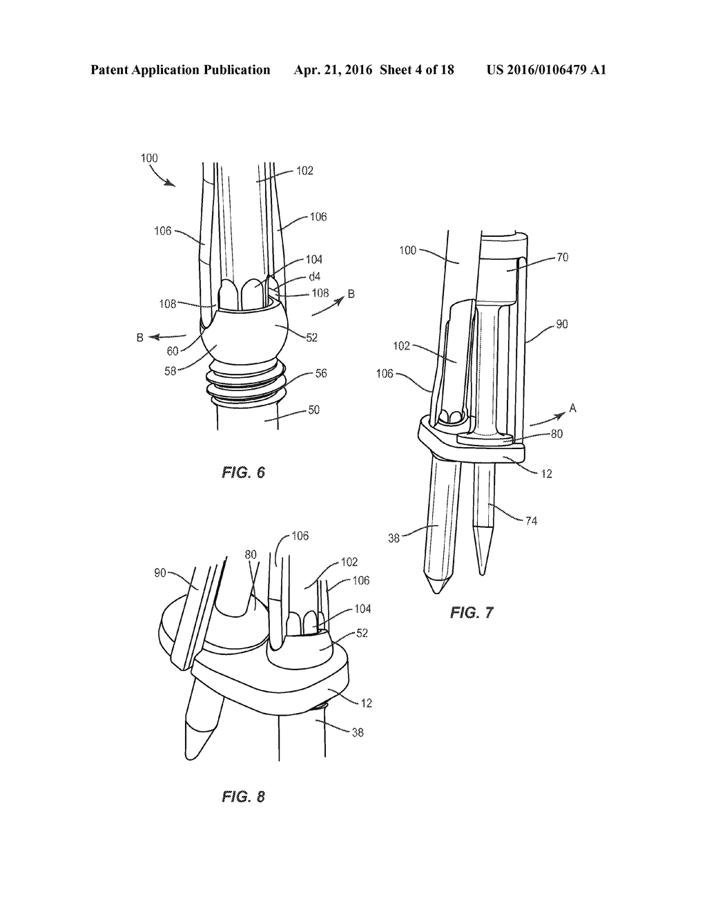 SPINAL IMPLANT SYSTEM AND METHOD - diagram, schematic, and image 05