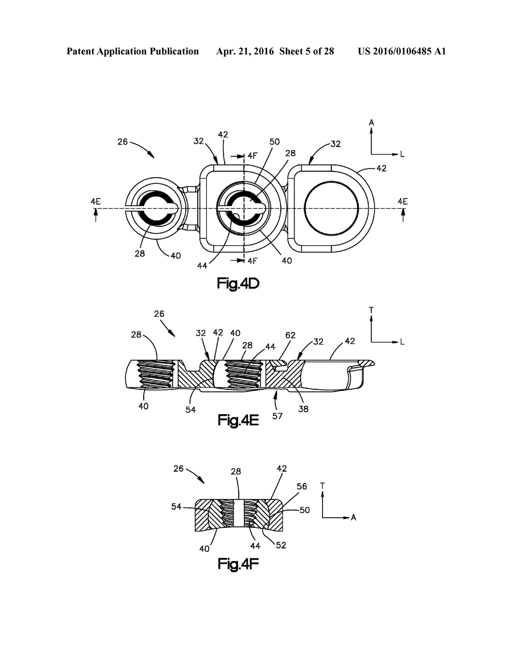 Bone Fixation System - diagram, schematic, and image 06