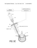 BONE TREATMENT SYSTEMS AND METHODS diagram and image