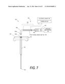 BONE TREATMENT SYSTEMS AND METHODS diagram and image