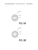 BONE TREATMENT SYSTEMS AND METHODS diagram and image