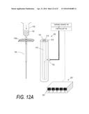 BONE TREATMENT SYSTEMS AND METHODS diagram and image