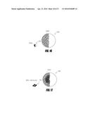 BONE TREATMENT SYSTEMS AND METHODS diagram and image