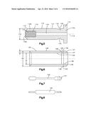 Nested Expandable Sleeve Implant diagram and image