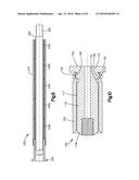 Nested Expandable Sleeve Implant diagram and image