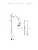 Endovascular Treatment Apparatus and Method diagram and image