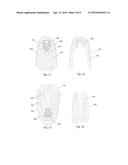 KIT AND METHOD FOR TAKING DENTAL IMPRESSIONS AND FORMING DENTAL MODELS diagram and image