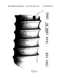 CERAMIC DENTAL IMPLANT diagram and image