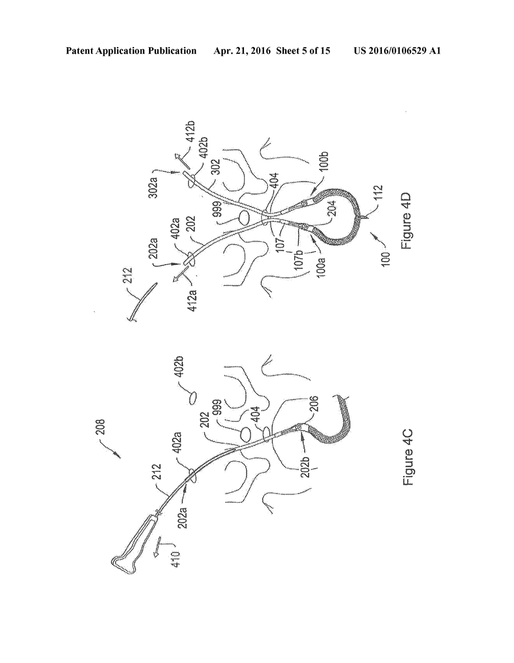 SYSTEMS AND METHODS EMPLOYING A PUSH TUBE FOR DELIVERING A URETHRAL SLING - diagram, schematic, and image 06