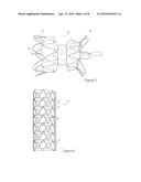 STENT GRAFT AND INTRODUCER ASSEMBLY diagram and image
