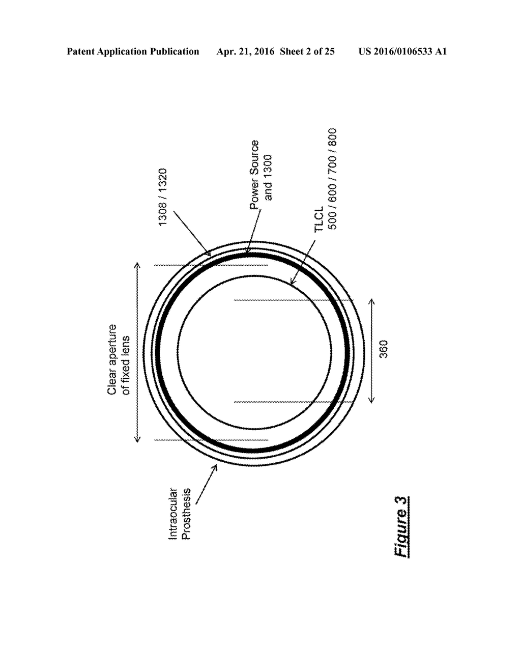 REPROGRAMMABLE TUNEABLE LIQUID CRYSTAL LENS INTRAOCULAR IMPLANT AND     METHODS THEREFOR - diagram, schematic, and image 03