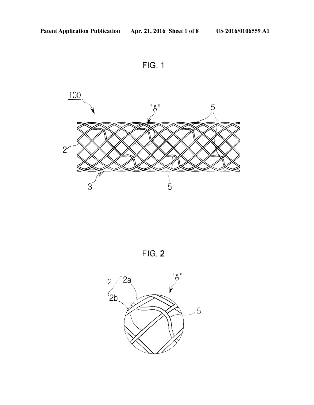 METHOD OF MANUFACTURING ANTI-MIGRATION STENT AND STENT MANUFACTURED     THEREBY - diagram, schematic, and image 02