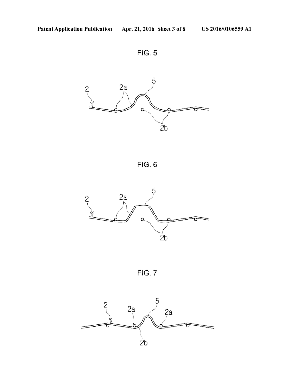 METHOD OF MANUFACTURING ANTI-MIGRATION STENT AND STENT MANUFACTURED     THEREBY - diagram, schematic, and image 04