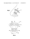 NASAL APPLIQUE AND RELATED APPLICATOR FOR APPLYING APPLIQUE TO A NOSE OF A     WEARER diagram and image