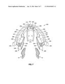 NASAL APPLIQUE AND RELATED APPLICATOR FOR APPLYING APPLIQUE TO A NOSE OF A     WEARER diagram and image