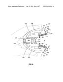 NASAL APPLIQUE AND RELATED APPLICATOR FOR APPLYING APPLIQUE TO A NOSE OF A     WEARER diagram and image