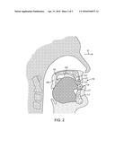 ORAL DEVICE FOR MANDIBULAR ADVANCEMENT AND MEDIAL TONGUE CONSTRAINT diagram and image