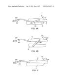 ORAL DEVICE FOR MANDIBULAR ADVANCEMENT AND MEDIAL TONGUE CONSTRAINT diagram and image