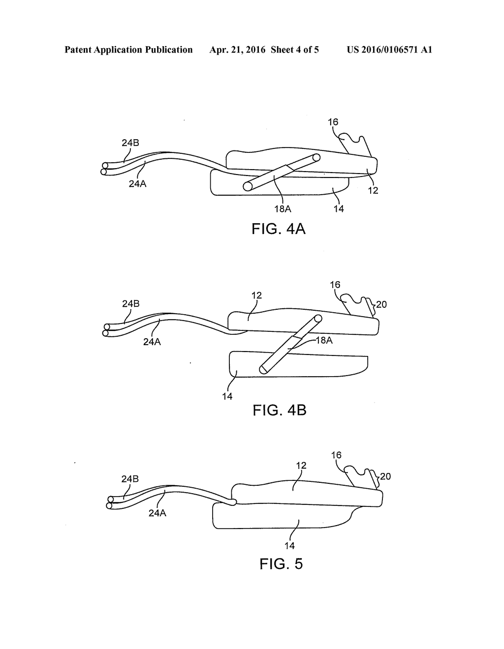 ORAL DEVICE FOR MANDIBULAR ADVANCEMENT AND MEDIAL TONGUE CONSTRAINT - diagram, schematic, and image 05