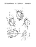 ORAL DEVICE FOR MANDIBULAR ADVANCEMENT AND MEDIAL TONGUE CONSTRAINT diagram and image