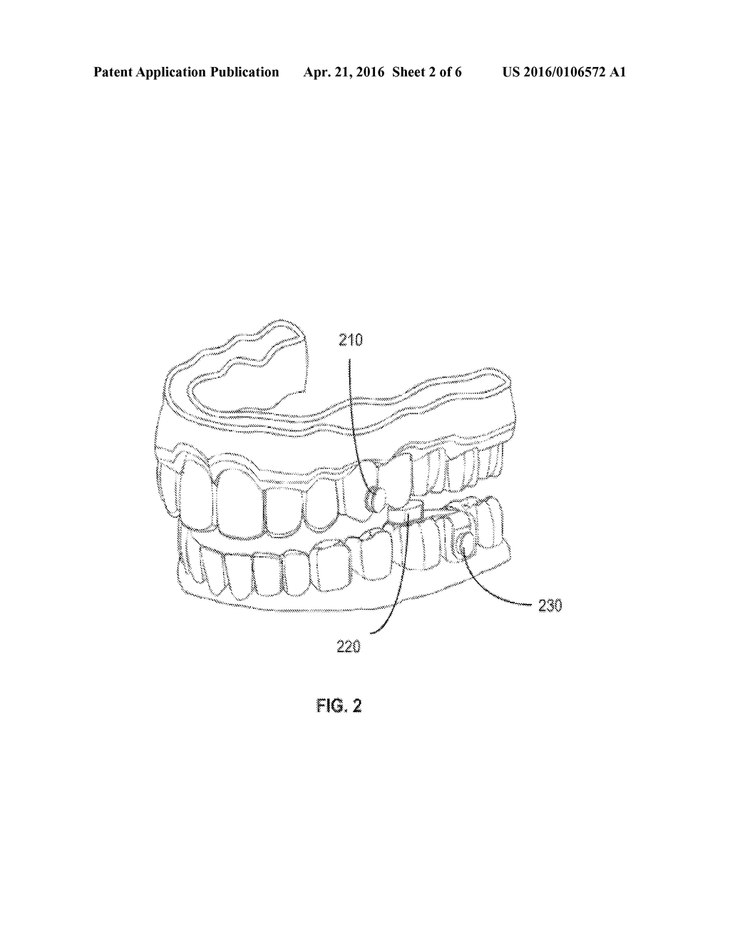 Method and Apparatus for Vacuum-Formed Dental Appliance - diagram, schematic, and image 03