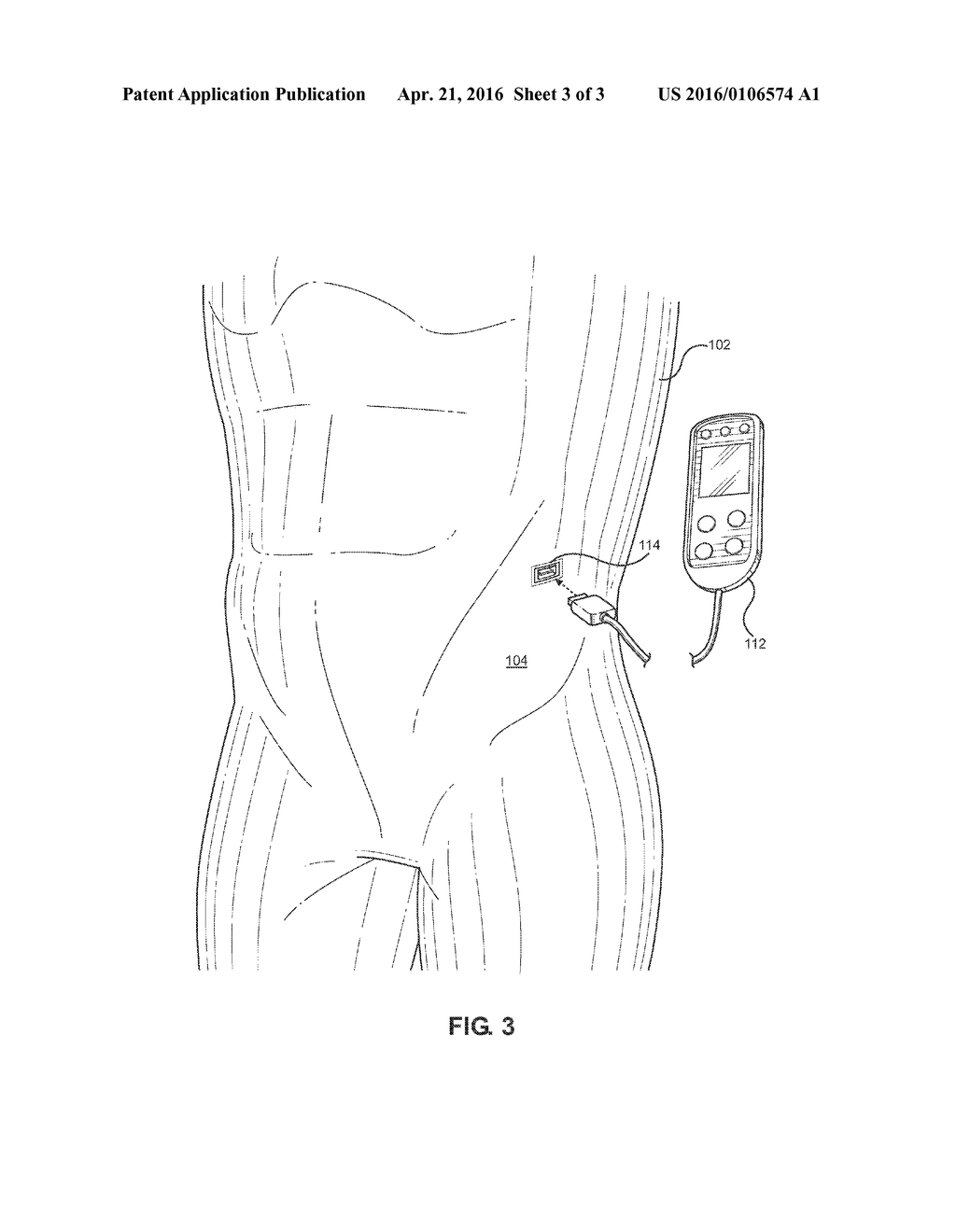 Thermal Body Suit - diagram, schematic, and image 04