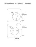 OCULAR GELS OR HYDROGELS AND MICROINJECTORS diagram and image