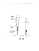 OCULAR GELS OR HYDROGELS AND MICROINJECTORS diagram and image