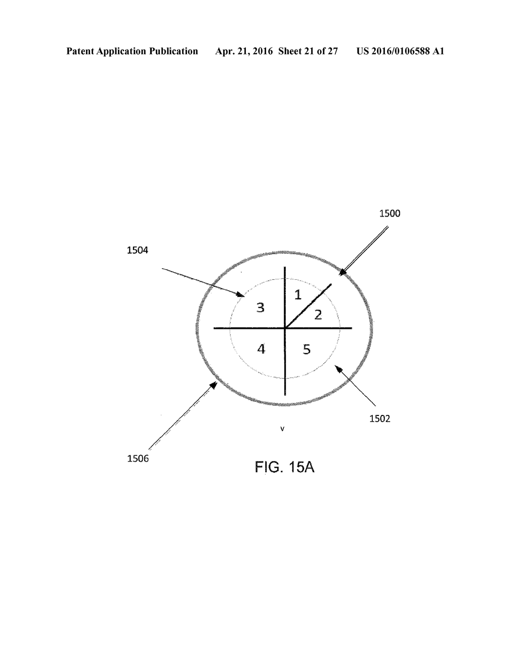 LASER EYE SURGERY LENS FRAGMENTATION - diagram, schematic, and image 22