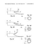 Devices and Methods Useable for Treatment of Glaucoma and Other Surgical     Prcedures diagram and image