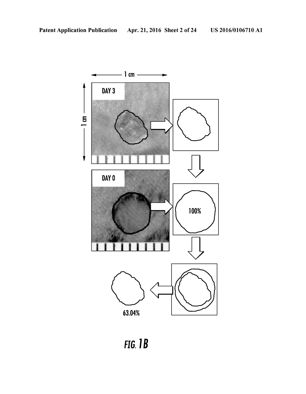 WOUND HEALING VIA AUTOLOGOUS STEM CELL MOBILIZATION - diagram, schematic, and image 03