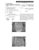 METHODS TO SENSE AND TREAT SUBCLINICAL SKIN DAMAGE diagram and image