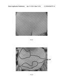 METHODS TO SENSE AND TREAT SUBCLINICAL SKIN DAMAGE diagram and image