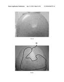 METHODS TO SENSE AND TREAT SUBCLINICAL SKIN DAMAGE diagram and image