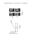 Novel bis-Benzylidine Piperidone Proteasome Inhibitor with Anticancer     Activity diagram and image