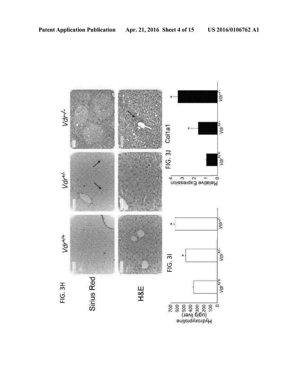 VITAMIN D RECEPTOR/SMAD GENOMIC CIRCUIT GATES FIBROTIC RESPONSE - diagram, schematic, and image 05