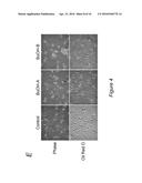 EPIGENETIC MECHANISMS OF ANTI-FIBROTIC ACTION FOR THE LIVER diagram and image