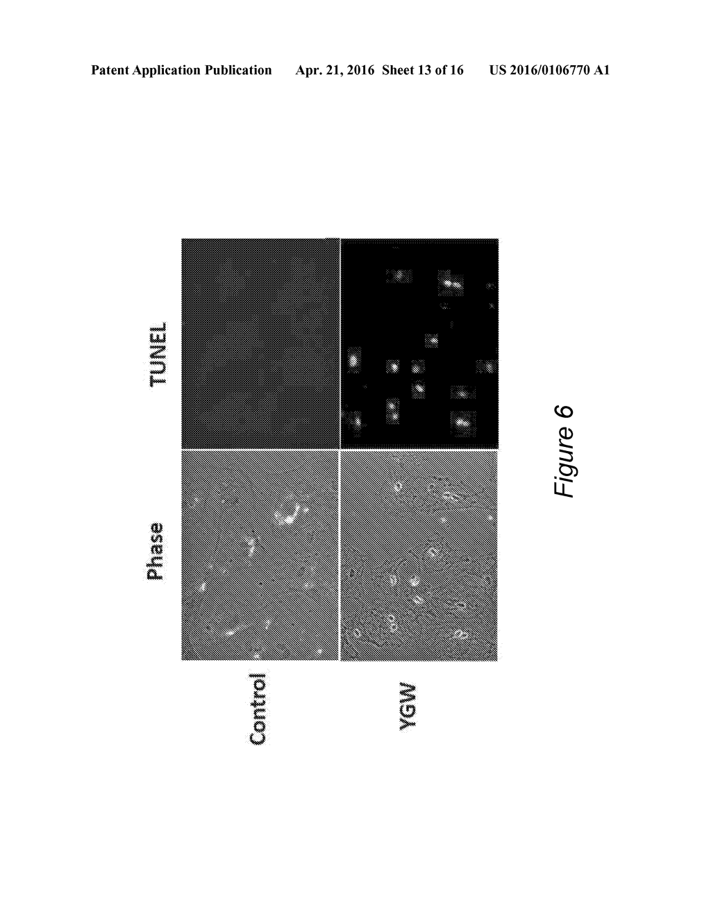 EPIGENETIC MECHANISMS OF ANTI-FIBROTIC ACTION FOR THE LIVER - diagram, schematic, and image 14