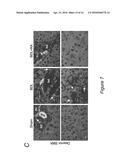 EPIGENETIC MECHANISMS OF ANTI-FIBROTIC ACTION FOR THE LIVER diagram and image