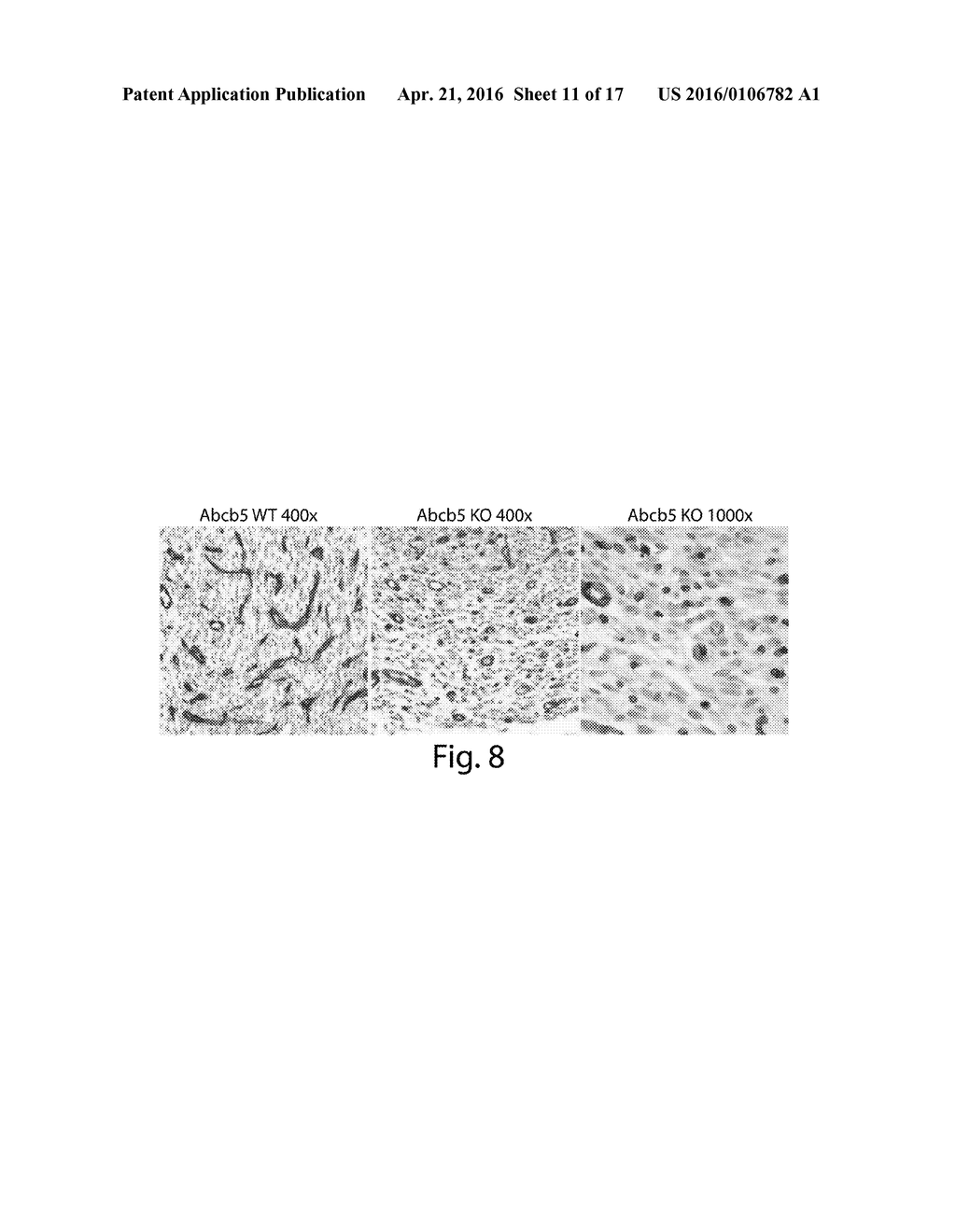 WOUND HEALING AND TISSUE ENGINEERING - diagram, schematic, and image 12