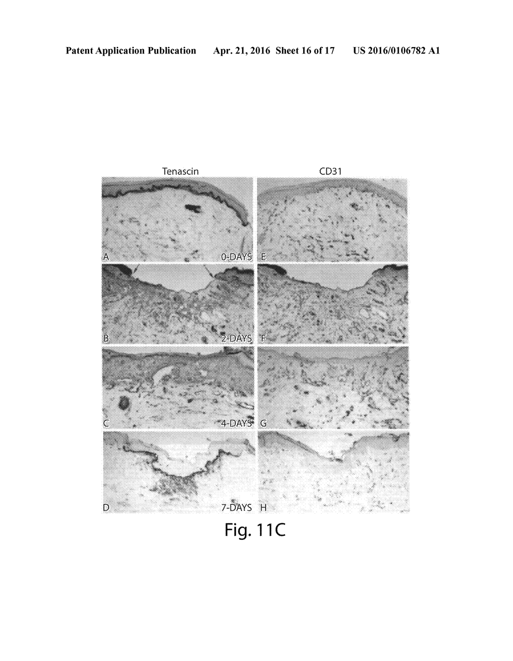 WOUND HEALING AND TISSUE ENGINEERING - diagram, schematic, and image 17