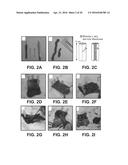 UMBILICAL CORD PRODUCTS diagram and image