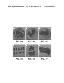 UMBILICAL CORD PRODUCTS diagram and image