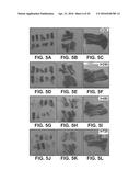 UMBILICAL CORD PRODUCTS diagram and image