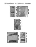 UMBILICAL CORD PRODUCTS diagram and image