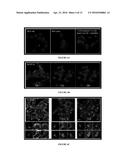 AXL ANTIBODY-DRUG CONJUGATE AND ITS USE FOR THE TREATMENT OF CANCER diagram and image