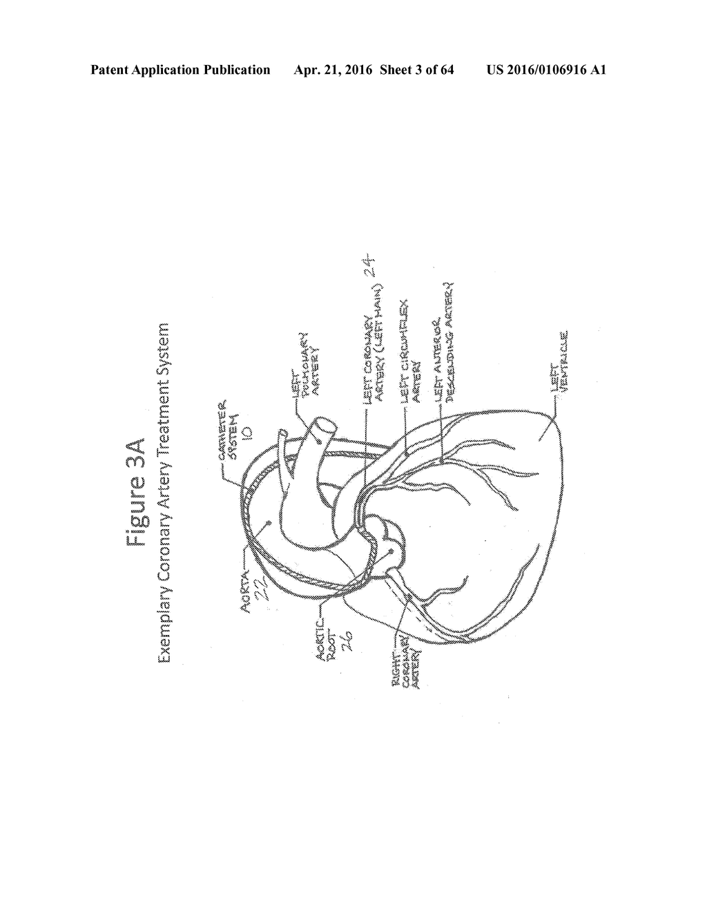 Reservoir for Collection and Reuse of Diverted Medium - diagram, schematic, and image 04