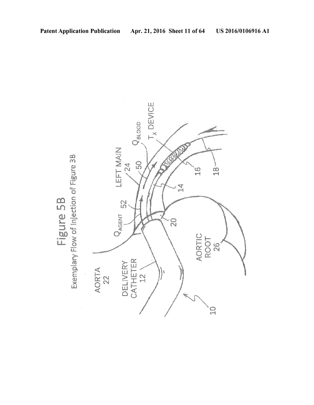 Reservoir for Collection and Reuse of Diverted Medium - diagram, schematic, and image 12